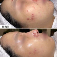 ブログ