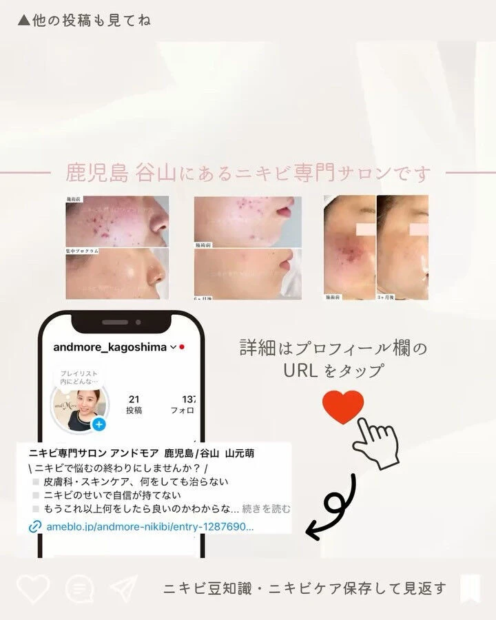 ブログ